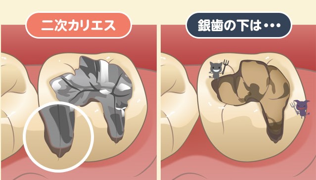 新琴似(札幌市北区)の歯医者、ふれあいの杜歯科・こども歯科の審美歯科